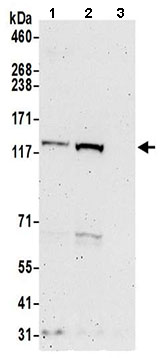 Western blot - Anti-FHOD1 antibody (AB206692)