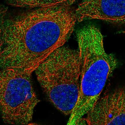 Immunocytochemistry/ Immunofluorescence - Anti-FHOD1 antibody (AB224461), expandable thumbnail