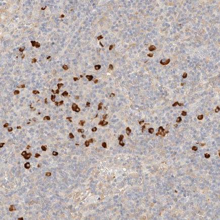 Immunohistochemistry (Formalin/PFA-fixed paraffin-embedded sections) - Anti-FHOD1 antibody (AB224461), expandable thumbnail