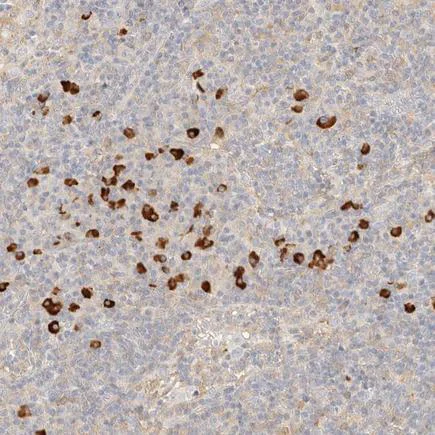 Immunohistochemistry (Formalin/PFA-fixed paraffin-embedded sections) - Anti-FHOD1 antibody (AB224461)