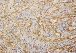 Immunohistochemistry (Formalin/PFA-fixed paraffin-embedded sections) - Anti-FHOD1 antibody (AB73443), expandable thumbnail
