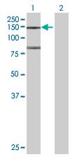 Western blot - Anti-FHOD1 antibody (AB73443), expandable thumbnail