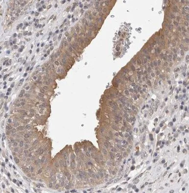 Immunohistochemistry (Formalin/PFA-fixed paraffin-embedded sections) - Anti-FHOD3 antibody (AB224463)