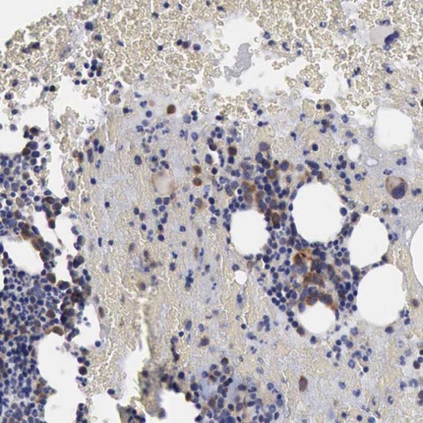 Immunohistochemistry (Formalin/PFA-fixed paraffin-embedded sections) - Anti-FIAT antibody (AB224215)