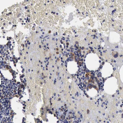 Immunohistochemistry (Formalin/PFA-fixed paraffin-embedded sections) - Anti-FIAT antibody (AB224215)