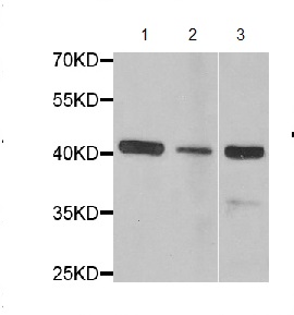 Western blot - Anti-FIBP antibody (AB194793)