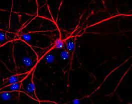 Immunocytochemistry/ Immunofluorescence - Anti-Fibrillarin antibody [38F3] - Nucleolar Marker (AB4566)