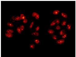 Immunocytochemistry/ Immunofluorescence - Anti-Fibrillarin antibody [EPR10823(B)] - Nucleolar Marker (AB166630), expandable thumbnail