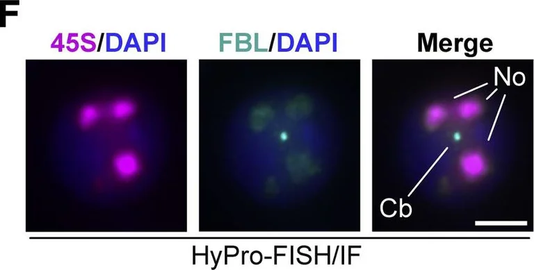 Immunocytochemistry/ Immunofluorescence - Anti-Fibrillarin antibody - Nucleolar Marker (AB5821)