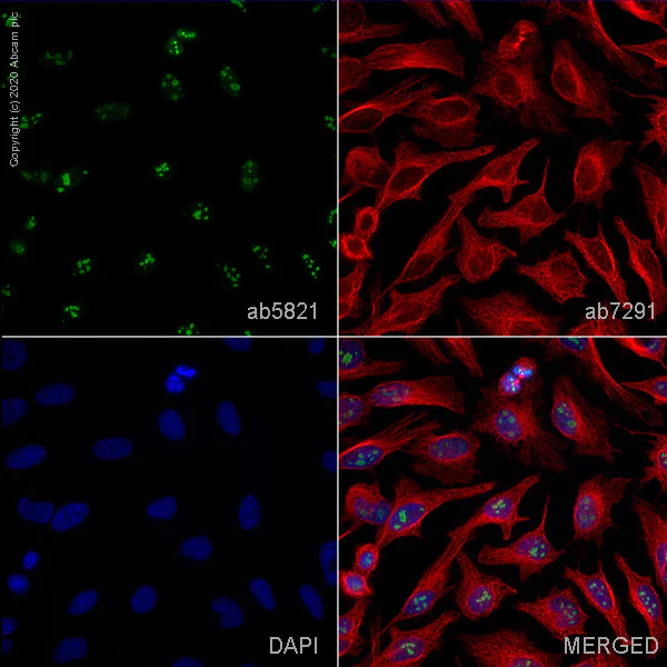 Immunocytochemistry/ Immunofluorescence - Anti-Fibrillarin antibody - Nucleolar Marker (AB5821)