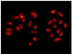 Immunocytochemistry/ Immunofluorescence - Anti-Fibrillarin+Fibrillarin-like protein 1 antibody [EPR10823(B)] - Nucleolar Marker (AB166630)