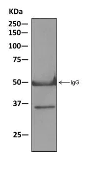 Western blot - Anti-Fibrillarin+Fibrillarin-like protein 1 antibody [EPR10823(B)] - Nucleolar Marker (AB166630)