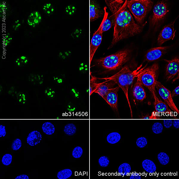 Immunocytochemistry/ Immunofluorescence - Anti-Fibrillarin+Fibrillarin-like protein 1 antibody [RM1082] (AB314506)