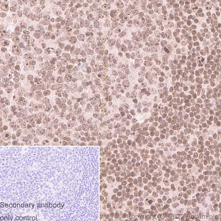 Immunohistochemistry (Formalin/PFA-fixed paraffin-embedded sections) - Anti-Fibrillarin+Fibrillarin-like protein 1 antibody [RM1082] (AB314506)
