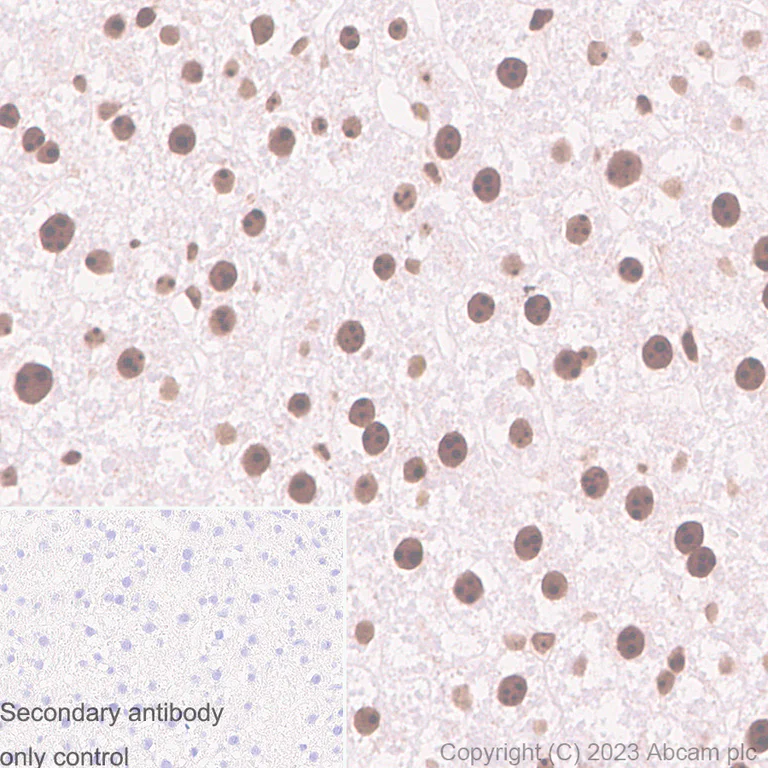 Immunohistochemistry (Formalin/PFA-fixed paraffin-embedded sections) - Anti-Fibrillarin+Fibrillarin-like protein 1 antibody [RM1082] (AB314506)