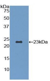 Western blot - Anti-Fibrillin 1 antibody (AB231094), expandable thumbnail
