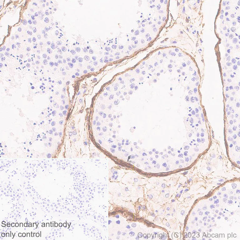 Immunohistochemistry (Formalin/PFA-fixed paraffin-embedded sections) - Anti-Fibrillin 1 antibody [EPR27362-76] (AB314547)