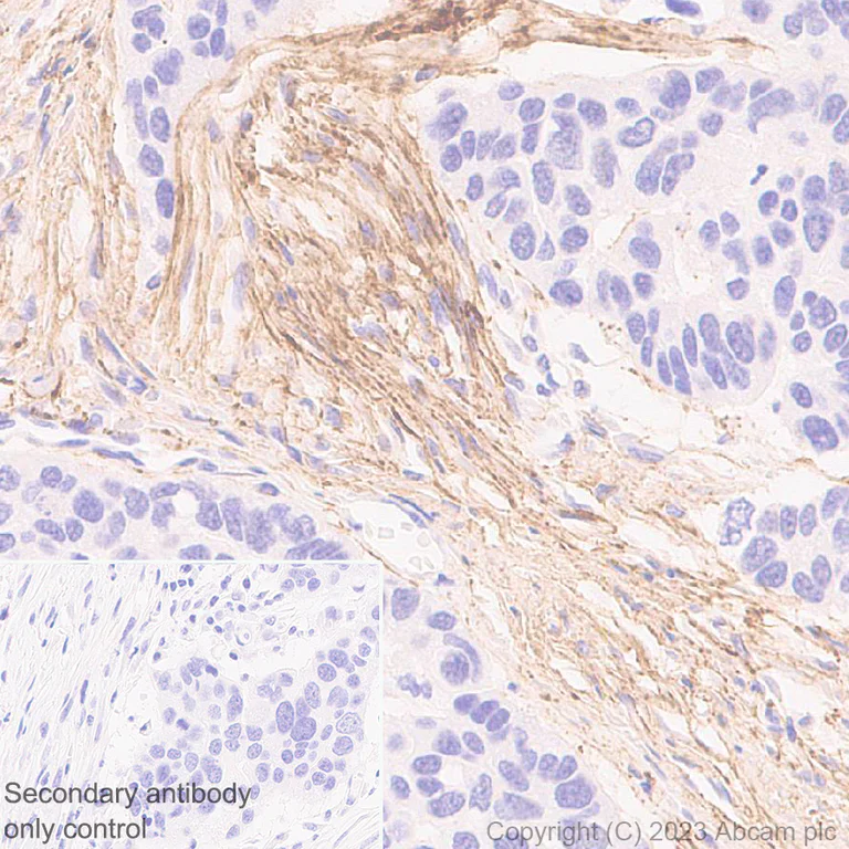 Immunohistochemistry (Formalin/PFA-fixed paraffin-embedded sections) - Anti-Fibrillin 1 antibody [EPR27362-76] (AB314547)