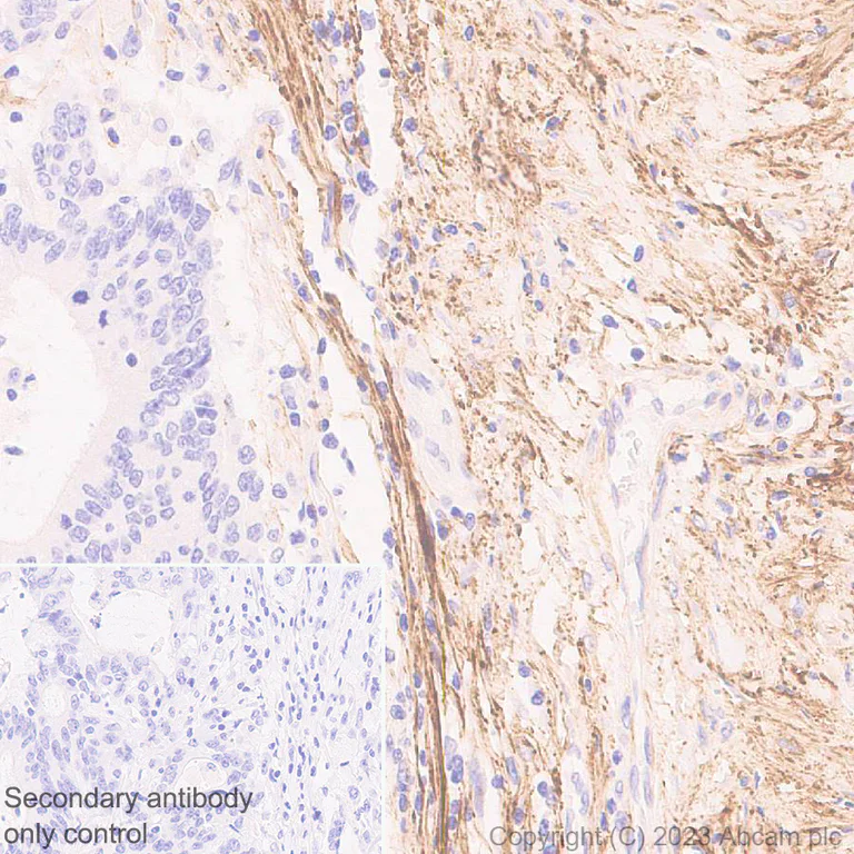 Immunohistochemistry (Formalin/PFA-fixed paraffin-embedded sections) - Anti-Fibrillin 1 antibody [EPR27362-76] (AB314547)