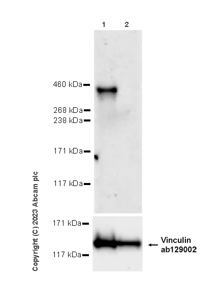 Western blot - Anti-Fibrillin 1 antibody [EPR27362-76] (AB314547)