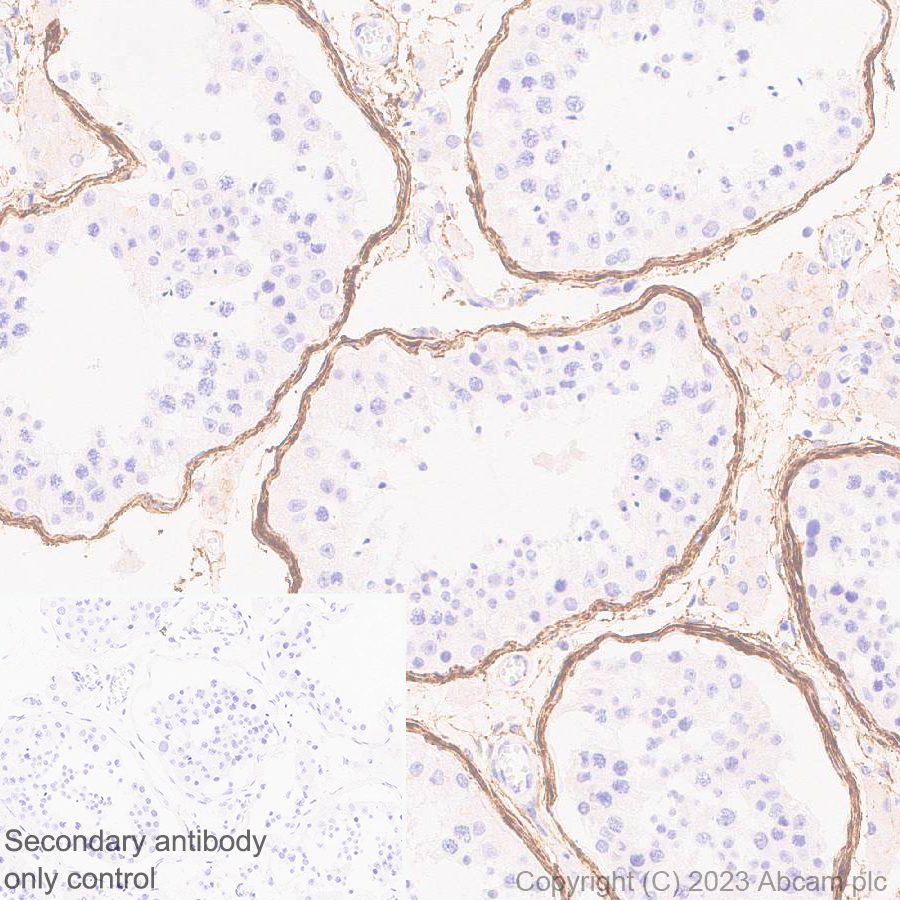 Immunohistochemistry (Formalin/PFA-fixed paraffin-embedded sections) - Anti-Fibrillin 1 antibody [EPR27362-78] - BSA and Azide free (ab315385), expandable thumbnail