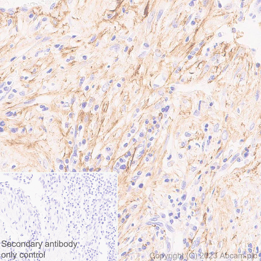 Immunohistochemistry (Formalin/PFA-fixed paraffin-embedded sections) - Anti-Fibrillin 1 antibody [EPR27362-78] - BSA and Azide free (ab315385), expandable thumbnail