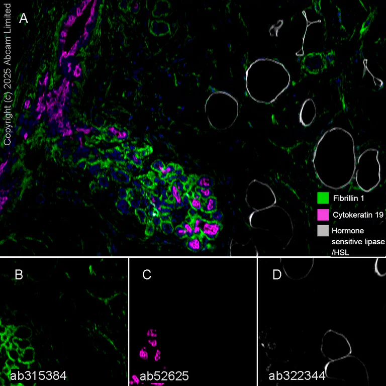 Multiplex immunohistochemistry - Anti-Fibrillin 1 antibody [EPR27362-78] - BSA and Azide free (AB315385)