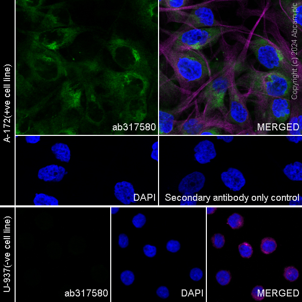 Immunocytochemistry/ Immunofluorescence - Anti-Fibrillin 1 antibody [RM1179] (ab317580), expandable thumbnail