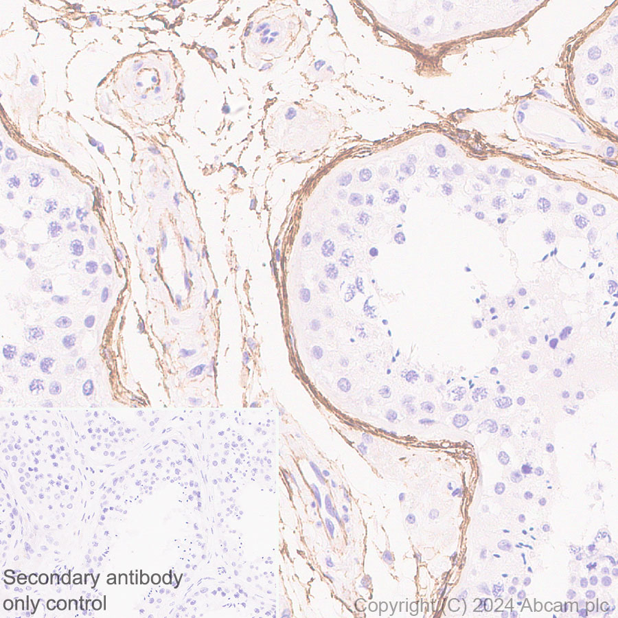 Immunohistochemistry (Formalin/PFA-fixed paraffin-embedded sections) - Anti-Fibrillin 1 antibody [RM1179] (ab317580), expandable thumbnail