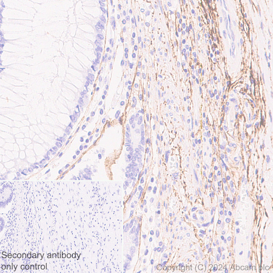 Immunohistochemistry (Formalin/PFA-fixed paraffin-embedded sections) - Anti-Fibrillin 1 antibody [RM1179] (ab317580), expandable thumbnail