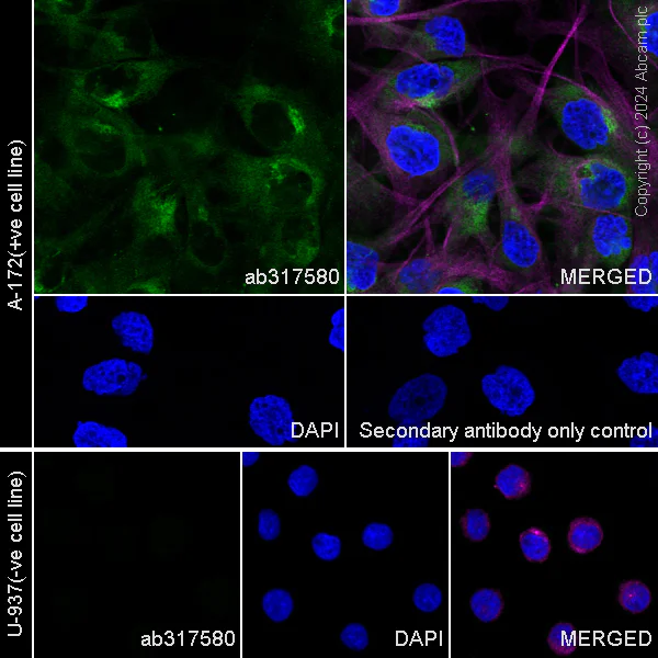 Immunocytochemistry/ Immunofluorescence - Anti-Fibrillin 1 antibody [RM1179] - BSA and Azide free (AB317581)