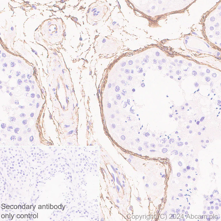 Immunohistochemistry (Formalin/PFA-fixed paraffin-embedded sections) - Anti-Fibrillin 1 antibody [RM1179] - BSA and Azide free (AB317581)