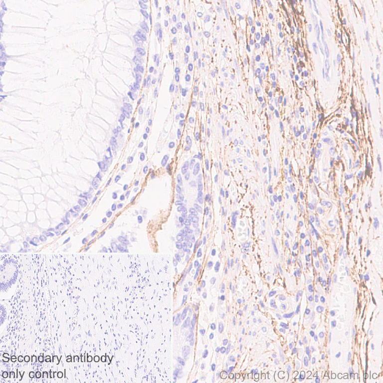 Immunohistochemistry (Formalin/PFA-fixed paraffin-embedded sections) - Anti-Fibrillin 1 antibody [RM1179] - BSA and Azide free (AB317581)