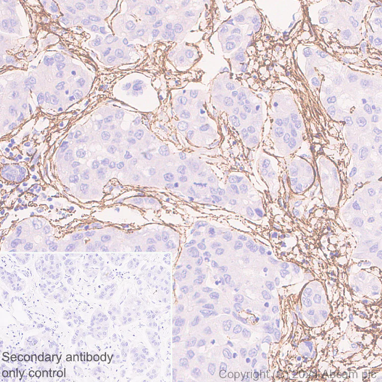 Immunohistochemistry (Formalin/PFA-fixed paraffin-embedded sections) - Anti-Fibrillin 1 antibody [RM1179] - BSA and Azide free (AB317581)
