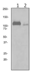 Western blot - Anti-Fibrinogen alpha chain antibody [EPR2918] - BSA and Azide free (AB232396)