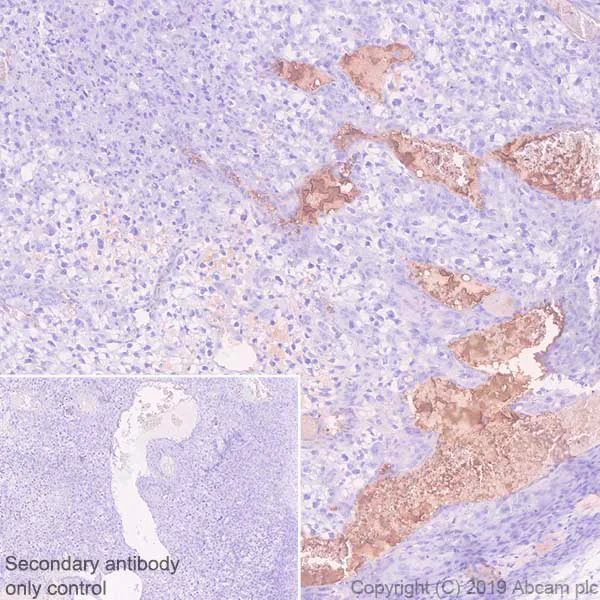 Immunohistochemistry (Formalin/PFA-fixed paraffin-embedded sections) - Anti-Fibrinogen alpha chain antibody [EPR2919] (AB92572)