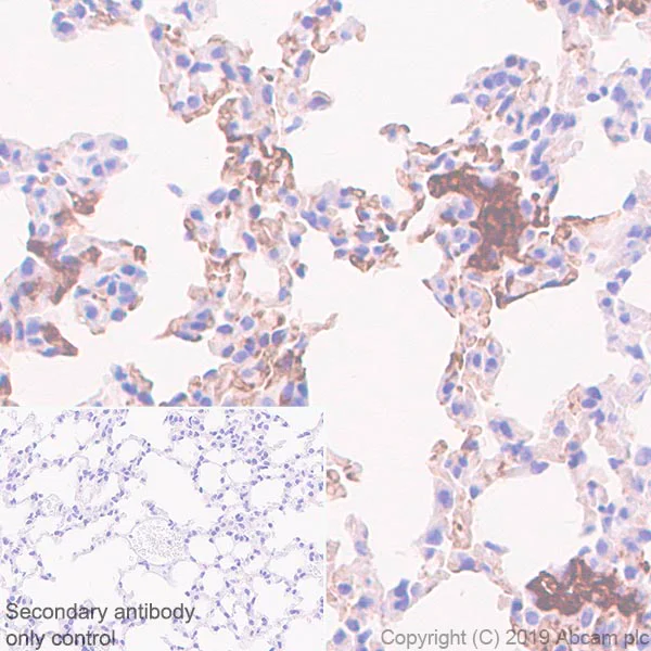 Immunohistochemistry (Formalin/PFA-fixed paraffin-embedded sections) - Anti-Fibrinogen alpha chain antibody [EPR2919] (AB92572)