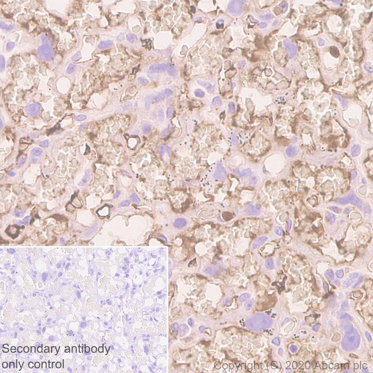 Immunohistochemistry (Formalin/PFA-fixed paraffin-embedded sections) - Anti-Fibrinogen alpha chain antibody [EPR2919] (AB92572)