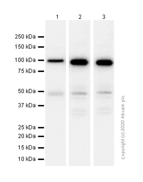 Western blot - Anti-Fibrinogen alpha chain antibody [EPR2919] (AB92572)