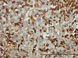 Immunohistochemistry (Formalin/PFA-fixed paraffin-embedded sections) - Anti-Fibrinogen antibody [1F2] (AB58207)