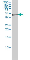 Western blot - Anti-Fibrinogen antibody [1F2] (AB58207), expandable thumbnail