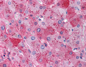 Immunohistochemistry (Formalin/PFA-fixed paraffin-embedded sections) - Anti-Fibrinogen antibody (AB118488), expandable thumbnail