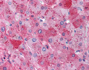 Immunohistochemistry (Formalin/PFA-fixed paraffin-embedded sections) - Anti-Fibrinogen antibody (AB118488)