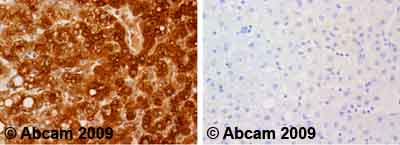 Immunohistochemistry (Formalin/PFA-fixed paraffin-embedded sections) - Anti-Fibrinogen antibody (AB34269), expandable thumbnail