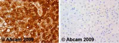 Immunohistochemistry (Formalin/PFA-fixed paraffin-embedded sections) - Anti-Fibrinogen antibody (AB34269)