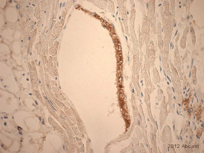Immunohistochemistry (Formalin/PFA-fixed paraffin-embedded sections) - Anti-Fibrinogen antibody (AB34269), expandable thumbnail