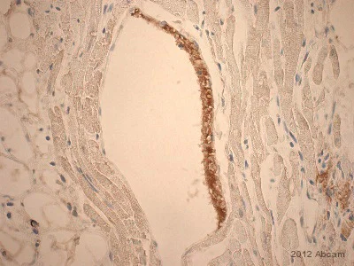 Immunohistochemistry (Formalin/PFA-fixed paraffin-embedded sections) - Anti-Fibrinogen antibody (AB34269)
