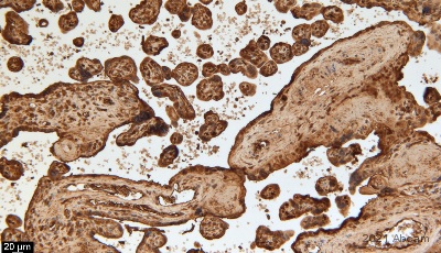 Immunohistochemistry (Formalin/PFA-fixed paraffin-embedded sections) - Anti-Fibrinogen antibody (ab34269), expandable thumbnail
