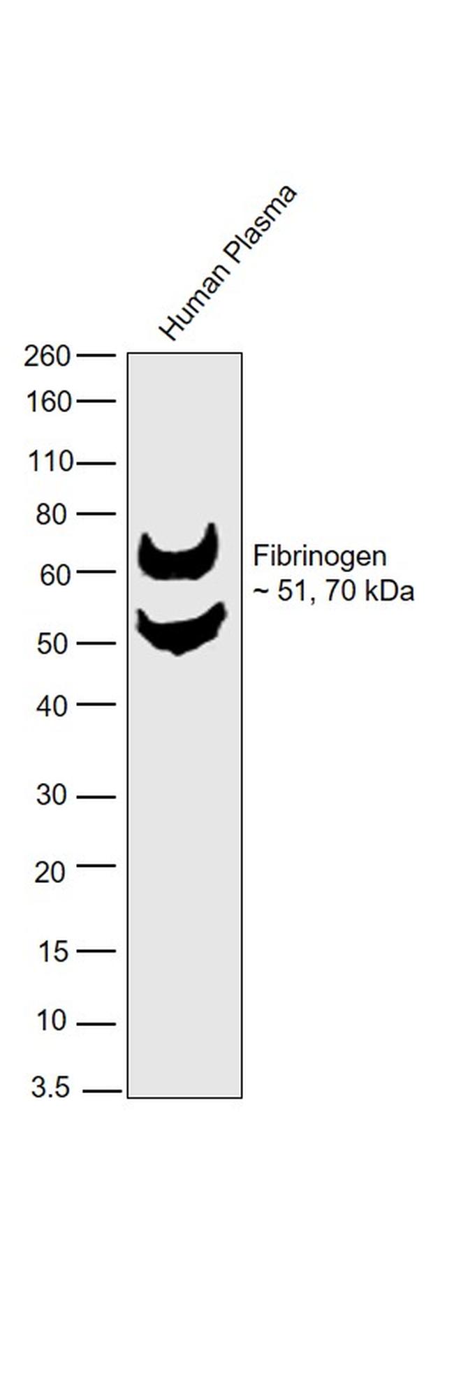 Western blot - Anti-Fibrinogen Antibody [RP23040077] (AB308109), expandable thumbnail