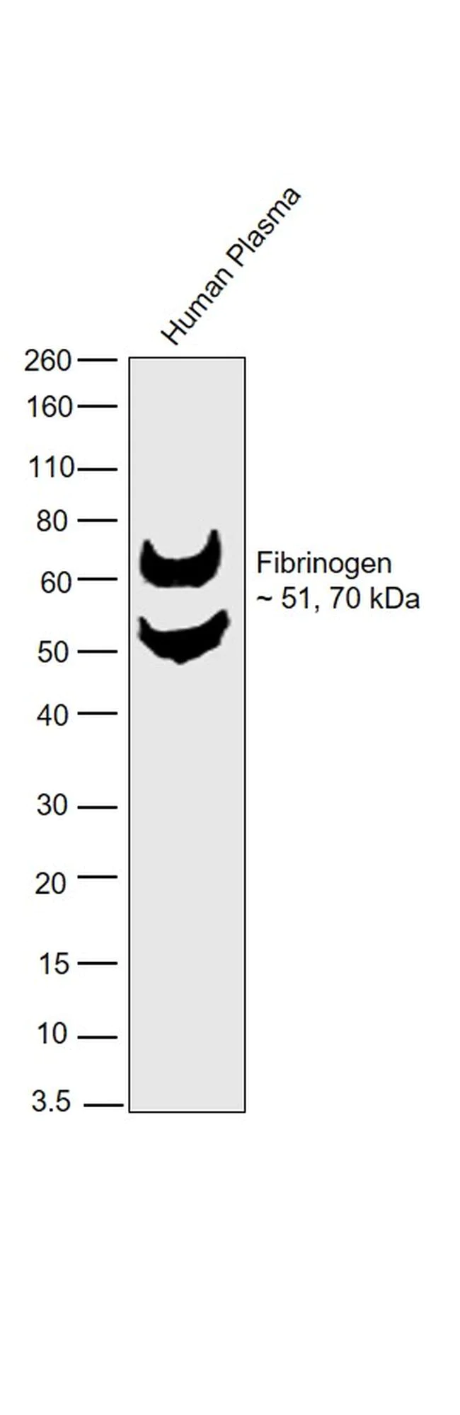 Western blot - Anti-Fibrinogen Antibody [RP23040077] (AB308109)